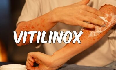 Vitilinox